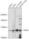 Integrator Complex Subunit 8 antibody, 18-073, ProSci, Western Blot image 