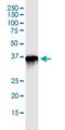 Parvin Gamma antibody, H00064098-D01P, Novus Biologicals, Immunoprecipitation image 