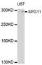 SPG11 Vesicle Trafficking Associated, Spatacsin antibody, abx126626, Abbexa, Western Blot image 