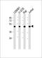 ETS Variant 6 antibody, A00361-2, Boster Biological Technology, Western Blot image 