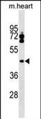 Leupaxin antibody, PA5-72020, Invitrogen Antibodies, Western Blot image 