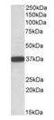 Cytochrome B5 Reductase 3 antibody, orb22553, Biorbyt, Western Blot image 