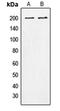 Tensin 1 antibody, orb214688, Biorbyt, Western Blot image 