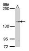 Transient Receptor Potential Cation Channel Subfamily M Member 2 antibody, PA5-22218, Invitrogen Antibodies, Western Blot image 