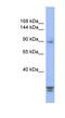 Protein Phosphatase 2 Regulatory Subunit B''Alpha antibody, NBP1-54581, Novus Biologicals, Western Blot image 