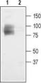 Chloride Voltage-Gated Channel 3 antibody, TA328779, Origene, Western Blot image 