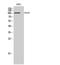 EPH Receptor A2 antibody, STJ92940, St John