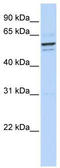 Glycoprotein Nmb antibody, TA335819, Origene, Western Blot image 