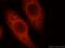 Matrix Extracellular Phosphoglycoprotein antibody, 23256-1-AP, Proteintech Group, Immunofluorescence image 