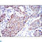 Apoptosis Inducing Factor Mitochondria Associated 1 antibody, LS-C812490, Lifespan Biosciences, Immunohistochemistry paraffin image 