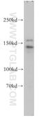 Rho GTPase Activating Protein 45 antibody, 14832-1-AP, Proteintech Group, Western Blot image 