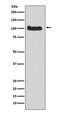 Protein Kinase D1 antibody, M01455, Boster Biological Technology, Western Blot image 