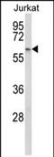 Propionyl-CoA Carboxylase Subunit Beta antibody, PA5-72584, Invitrogen Antibodies, Western Blot image 