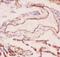 Collagen Type IV Alpha 1 Chain antibody, LS-C343962, Lifespan Biosciences, Immunohistochemistry paraffin image 