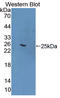 Formin Binding Protein 1 antibody, LS-C372971, Lifespan Biosciences, Western Blot image 