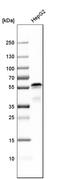 Ajuba LIM Protein antibody, HPA006171, Atlas Antibodies, Western Blot image 