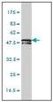 Keratin 81 antibody, AM20909PU-N, Origene, Western Blot image 