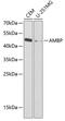 Alpha-1-Microglobulin/Bikunin Precursor antibody, GTX55504, GeneTex, Western Blot image 