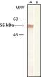 Tubulin Beta 2A Class IIa antibody, NB120-11308, Novus Biologicals, Western Blot image 