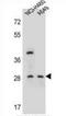 Spermatogenesis Associated Serine Rich 1 antibody, AP54005PU-N, Origene, Western Blot image 