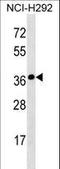 Synaptoporin antibody, LS-C157121, Lifespan Biosciences, Western Blot image 