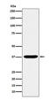 Aldo-Keto Reductase Family 1 Member C1 antibody, M03056-1, Boster Biological Technology, Western Blot image 