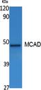 Acyl-CoA Dehydrogenase Medium Chain antibody, A02383, Boster Biological Technology, Western Blot image 