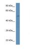 Phosphatidylinositol 4-Kinase Type 2 Beta antibody, NBP1-74233, Novus Biologicals, Western Blot image 