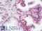 Apurinic/Apyrimidinic Endodeoxyribonuclease 1 antibody, LS-B10216, Lifespan Biosciences, Immunohistochemistry paraffin image 