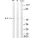 Kruppel Like Factor 11 antibody, EKC1625, Boster Biological Technology, Western Blot image 