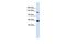 Regulator of G-protein signaling 22 antibody, GTX45299, GeneTex, Western Blot image 