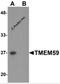 Transmembrane Protein 59 antibody, 6063, ProSci, Western Blot image 