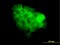 Signal Transducer And Activator Of Transcription 2 antibody, LS-C198277, Lifespan Biosciences, Immunofluorescence image 
