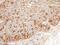 Branched Chain Keto Acid Dehydrogenase Kinase antibody, PA5-28050, Invitrogen Antibodies, Immunohistochemistry paraffin image 