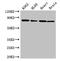 Bruton Tyrosine Kinase antibody, CSB-PA002867LA01HU, Cusabio, Western Blot image 