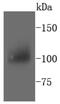 Protein Tyrosine Kinase 2 Beta antibody, NBP2-67627, Novus Biologicals, Western Blot image 