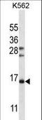 Follicle Stimulating Hormone Subunit Beta antibody, LS-C166260, Lifespan Biosciences, Western Blot image 