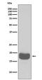 Eukaryotic Translation Initiation Factor 4E Binding Protein 1 antibody, M00968, Boster Biological Technology, Western Blot image 