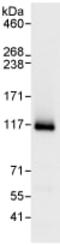 ERCC Excision Repair 4, Endonuclease Catalytic Subunit antibody, ab76948, Abcam, Immunoprecipitation image 
