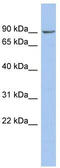 Nephrocystin 1 antibody, TA335137, Origene, Western Blot image 