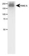 FA Complementation Group A antibody, PA1-46122, Invitrogen Antibodies, Western Blot image 