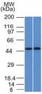 Fli-1 Proto-Oncogene, ETS Transcription Factor antibody, GTX34734, GeneTex, Western Blot image 