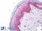 Keratin 5 antibody, LS-B8554, Lifespan Biosciences, Immunohistochemistry frozen image 