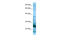 Ribosomal Protein L15 antibody, ARP65141_P050, Aviva Systems Biology, Western Blot image 