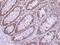DEAD-Box Helicase 3 X-Linked antibody, PA5-29170, Invitrogen Antibodies, Immunohistochemistry frozen image 