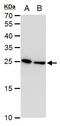 Triosephosphate Isomerase 1 antibody, MA5-18284, Invitrogen Antibodies, Western Blot image 