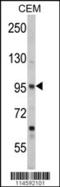 Semaphorin 3A antibody, 63-186, ProSci, Western Blot image 