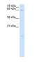 Phospholipase A And Acyltransferase 4 antibody, NBP1-59395, Novus Biologicals, Western Blot image 