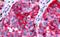 G Protein-Coupled Receptor 89A antibody, NLS1734, Novus Biologicals, Immunohistochemistry paraffin image 