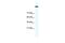 DNA Topoisomerase II Alpha antibody, GTX77787, GeneTex, Western Blot image 
